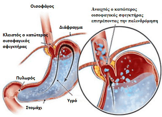 κατώτερος οισοφαγικός σφιγκτήρας