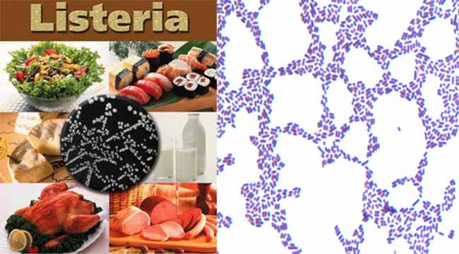Listeria monocytogenes
