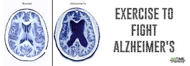 Αλτσχάιμερ & Πρόληψη: Τρόποι για να θωρακίσουμε τον οργανισμό μας