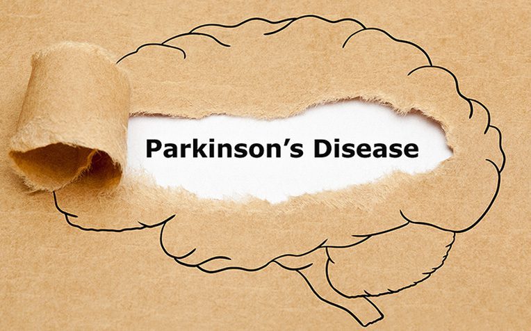 parkinson