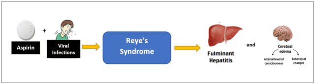 reye's syndrome