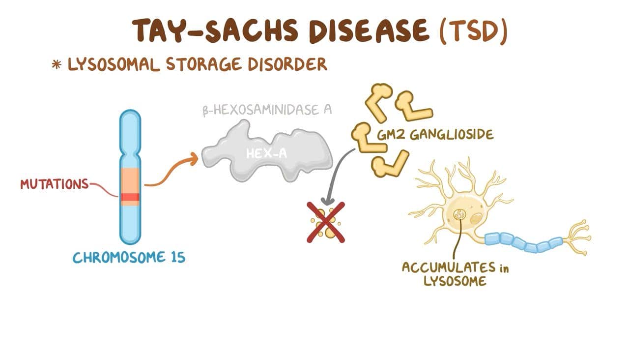 Tay-Sachs