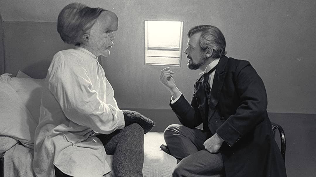 The Elephant Man