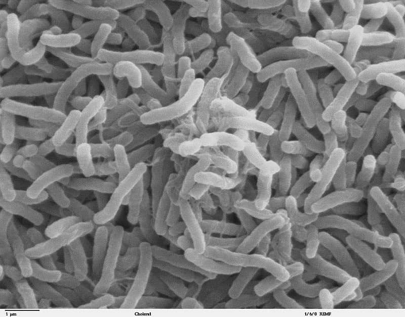 Το βακτήριο vibrio cholerae που προκαλεί τη χολέρα 