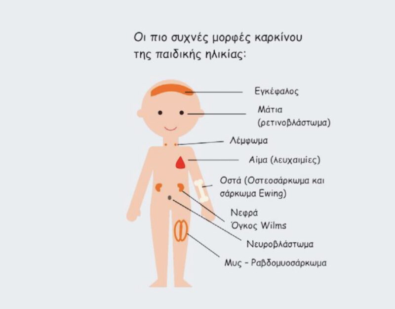 Καρκίνος Παιδικής Ηλικίας