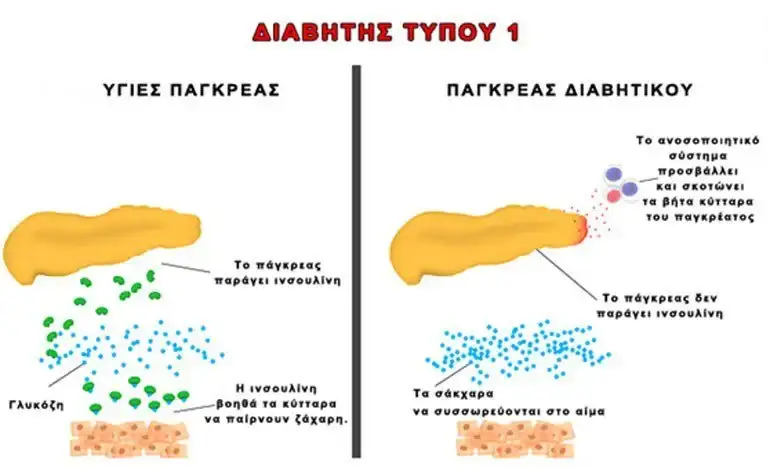 κύτταρα παγκρέατος
