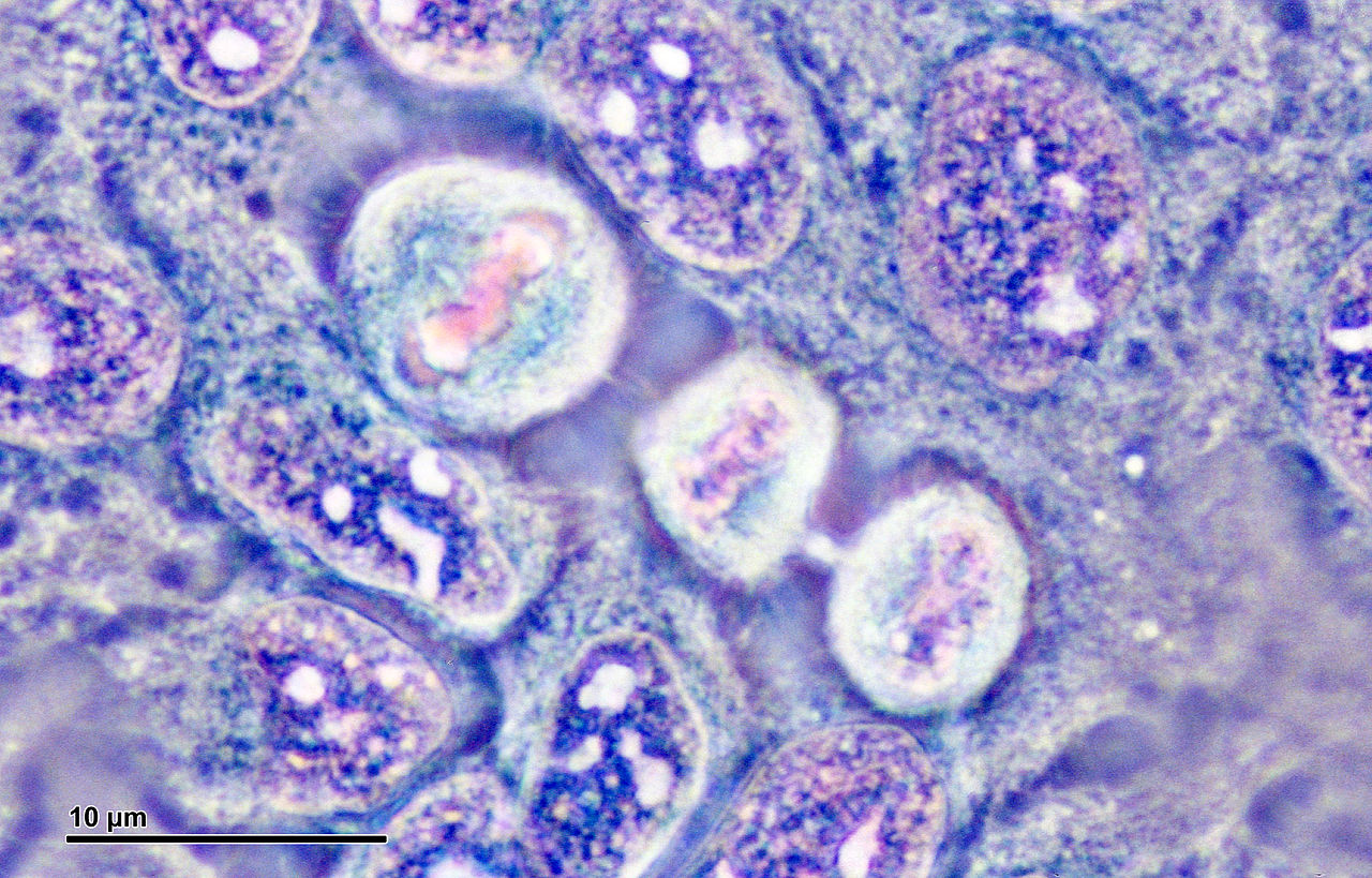 Henrietta Lacks