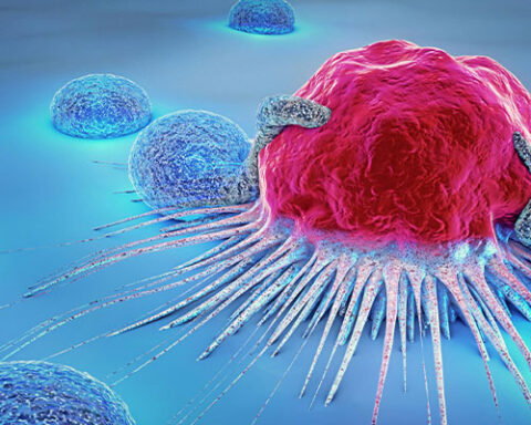 Betul. (2025, October 17). What are the symptoms of cancer? - Aktif International Hospital. Aktif International Hospital. https://www.aktifinternational.com/en/what-you-need-to-know-about-cancer/