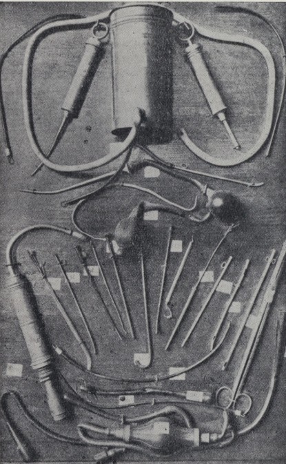 Ιατρικά εργαλεία που χρησιμοποιούνται σε παράνομες αμβλώσεις | Πηγή Εικόνας: nationalgeographic.com