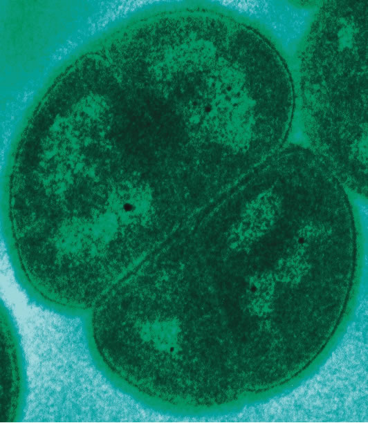 Το βακτήριο Deinococcus radiodurans